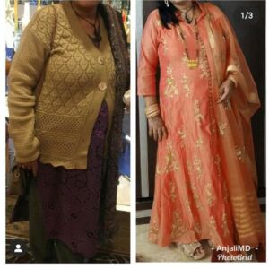 Diabetes Anajali Hooda Functional Medicine XXX