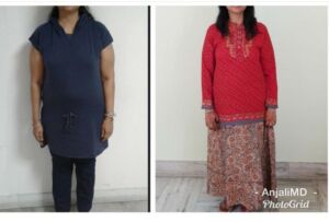 Diabetes Anajali Hooda Functional Medicine XYZ